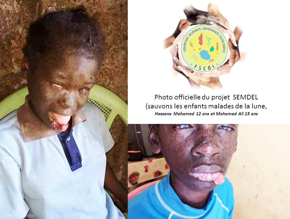 L’évacuation sanitaire  de Mohamed et Hassana serait autorisée