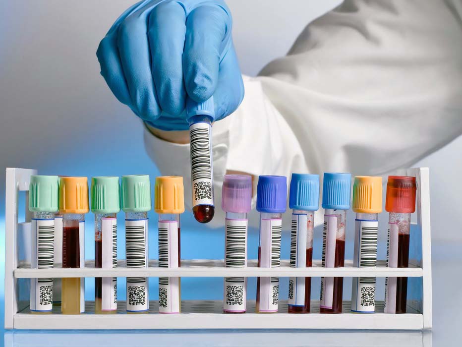 Le laboratoire d’analyse de Santé Militaire serait-il défaillant?