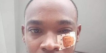 Le journaliste Oubeidillah Mchangama agressé lors d’une visite à la prison de Moroni