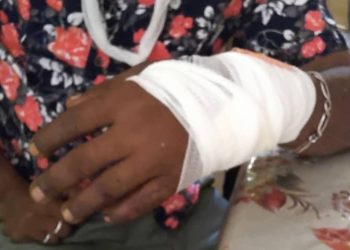 Recrudescence des violences. Una attaque à la machette à Anjouan