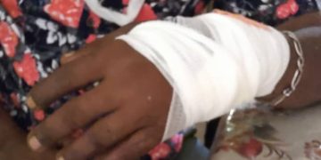 Recrudescence des violences. Una attaque à la machette à Anjouan