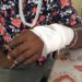 Recrudescence des violences. Una attaque à la machette à Anjouan